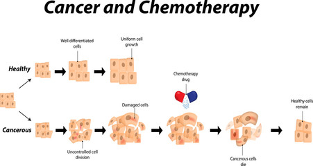 Cancer and Chemotherapy