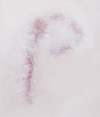 Scar letter P on human skin