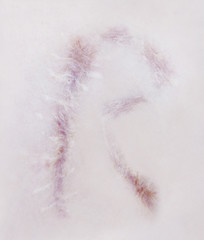 Scar letter R on human skin