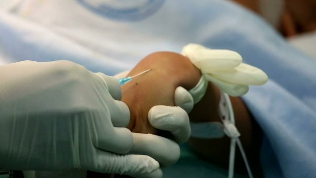 Nurse applying a cannula (catheter) in the vein.