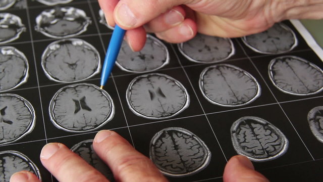 Arzt schaut sich Kernspinnaufnahmen an