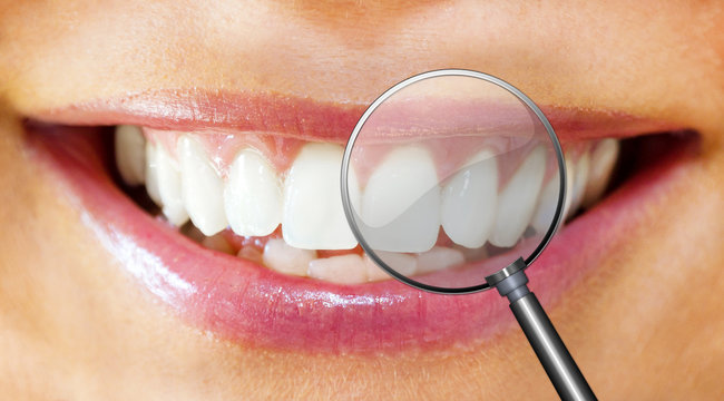 Dental care