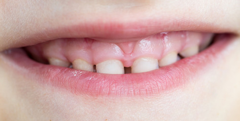 baby teeth. macro