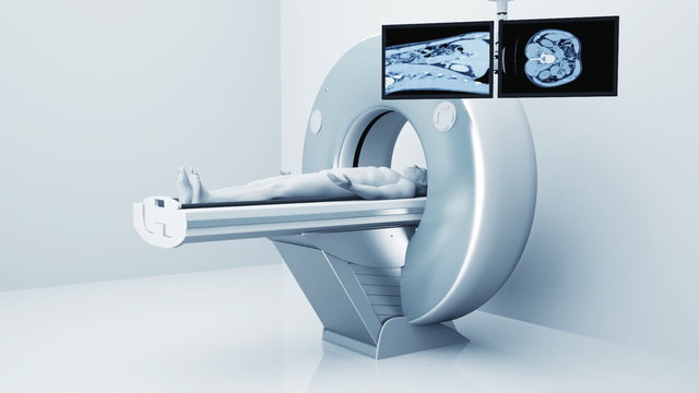 Man getting tomography Scan in hospital. 3d video