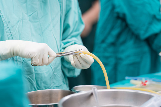 scrub nurse preparing chest drain for open heart surgery