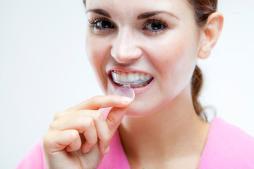 Teeth whitening, woman with tooth tray
