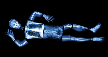 X-ray whole human's body (sleeping)