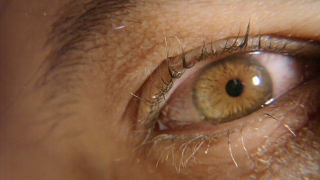 Eye red sick macro 1