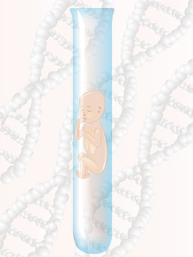 A child in a test tube - IVF