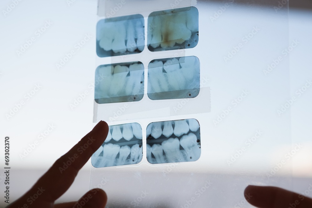 Poster dentists looking and pointing to xray