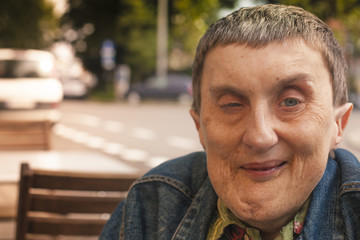 Close-up portraiture of disabled man sitting at an outdoor cafe.