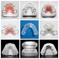 Essix retainer surrounded by orthodontic appliances and models