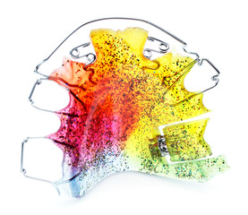 Multicolored and glittered orthodontic appliance for a child