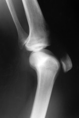knee bone computer x ray a images