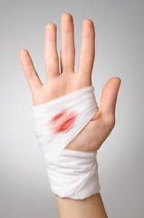 Hand with bloody bandage © Csaba Deli