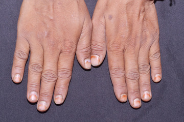 female hands