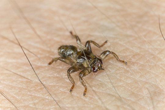 Deer fly, Lipoptena cervi crawling on human skin