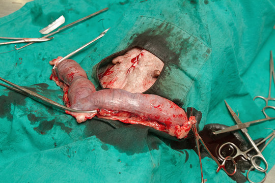  Surgery of pyometra (uterus infection)  in the dog