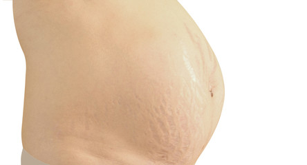 Closeup of a pregnant belly with stretch marks. Isolated on whit