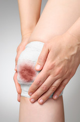 Injured knee with bloody bandage