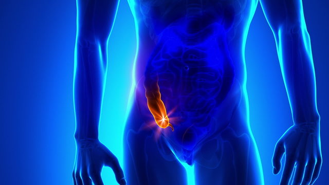 Appendix pain
