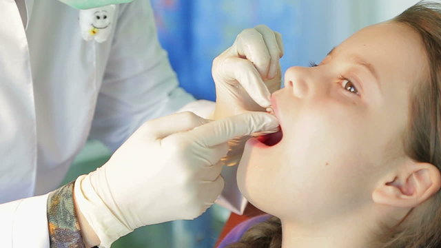 Dentist Fitting Plate For Crooked Teeth In Girl’s Mouth