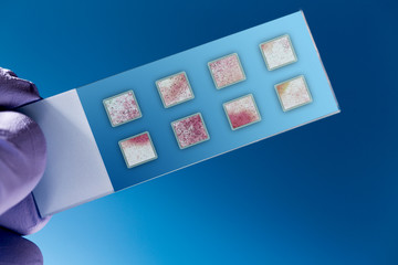 Biochip