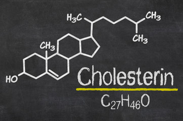 Schiefertafel mit der chemischen Formel von Cholesterin