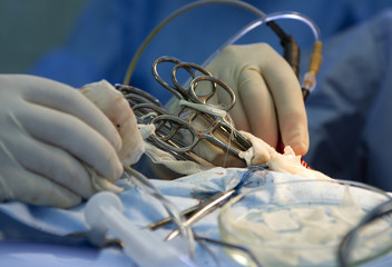 surgery, Medical Instrument