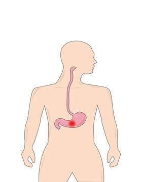gastrointestinal