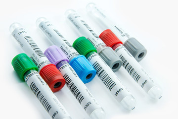 Medical test tubes with blood in laboratory