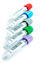 Medical test tubes with blood in laboratory