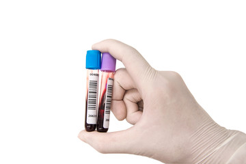 Hand with latex glove holding blood in test tube