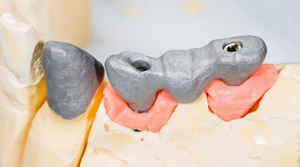 Metal framework bridge