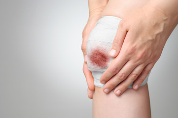Injured knee with bloody bandage