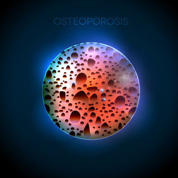 Osteoporosis round illustration on a abstract blue background