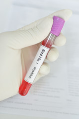 Obraz premium Bird Flu positive
