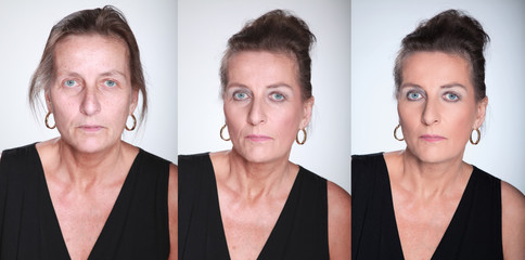 Vorher Nachher Reife Frau Gesicht Vergleich Porträt