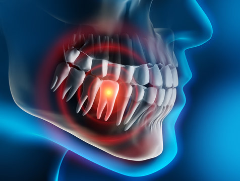Zahnschmerz