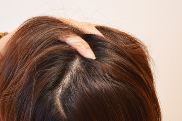 30代女性の髪の毛