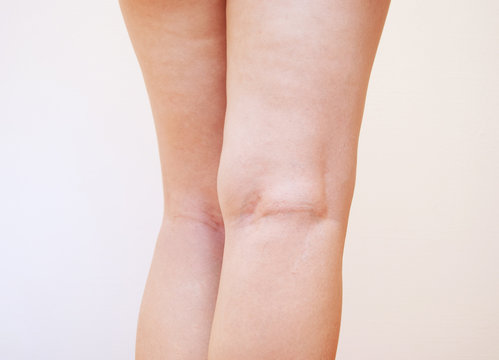 膝裏 Images Browse 59 Stock Photos Vectors And Video Adobe Stock