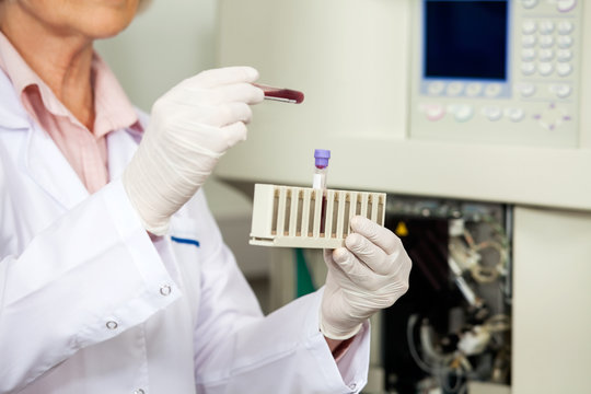 Scientist Analyzing Blood Sample In Laboratory