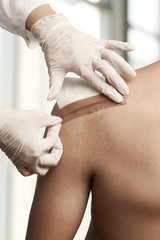 Dressing the wound