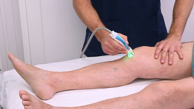 Laser yag therapy