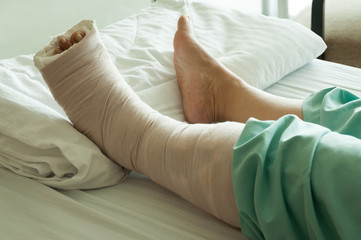 Broken Leg