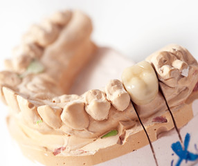 Dental prothetic