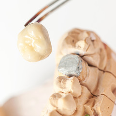 Dental prothetic