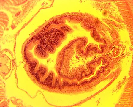Earthworm transverse slit - permanent slide plate