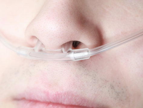 Oxygen lines in the nose of an asthmatic