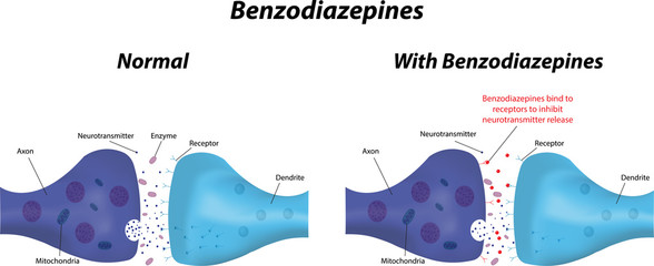 Benzodiazepines